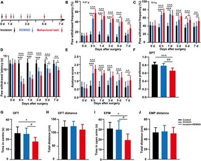 Perioperative sleep deprivation activates the paraventricular thalamic nucleus resulting in persistent postoperative incisional pain in mice